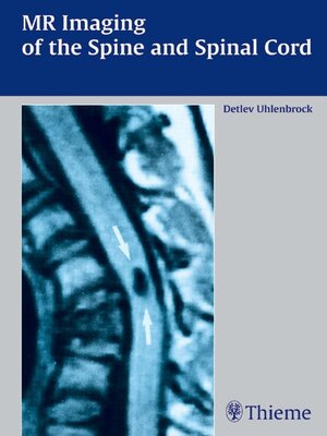 cover image of MR Imaging of the Spine and Spinal Cord